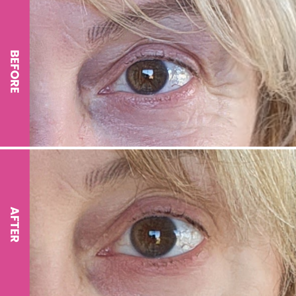 PrimeEyes Hydrate