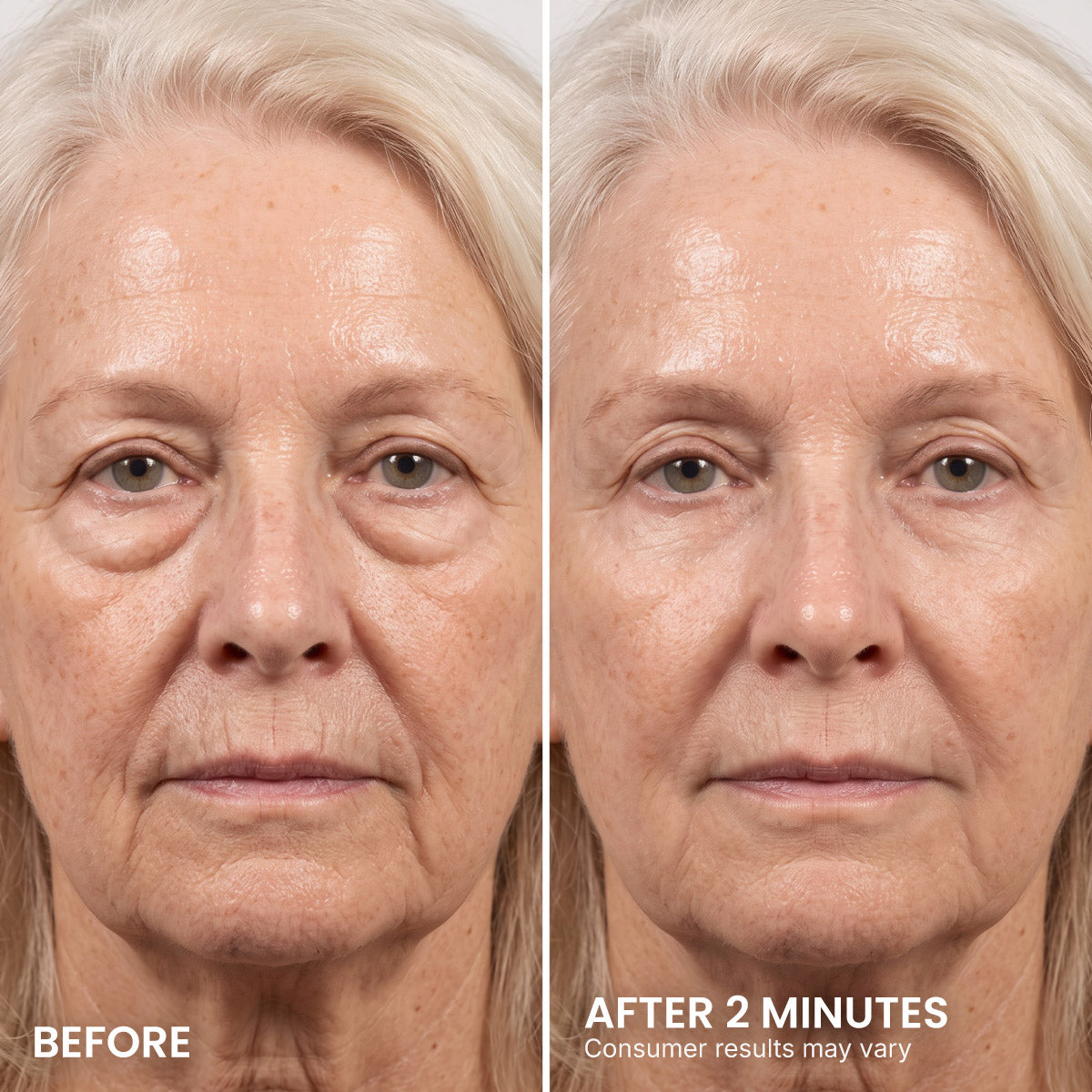 PrimeLift Instant Eye Tightener