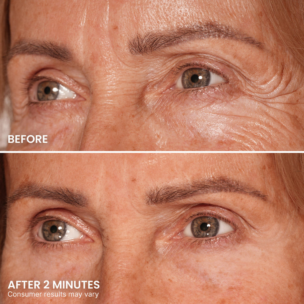 PrimeLift Instant Eye Tightener