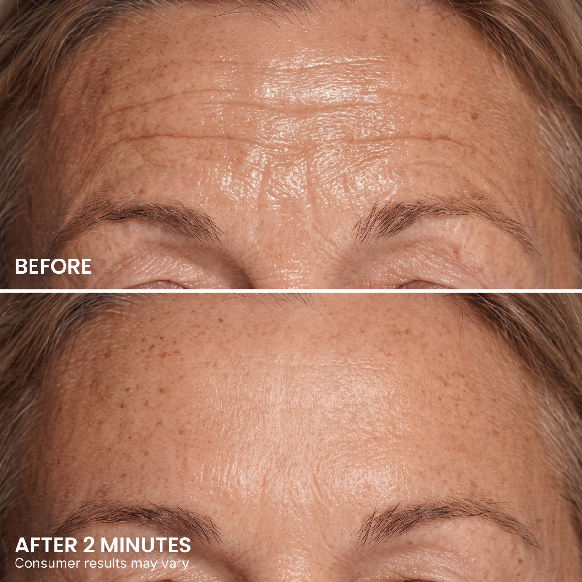 PrimeLift Instant Eye Tightener